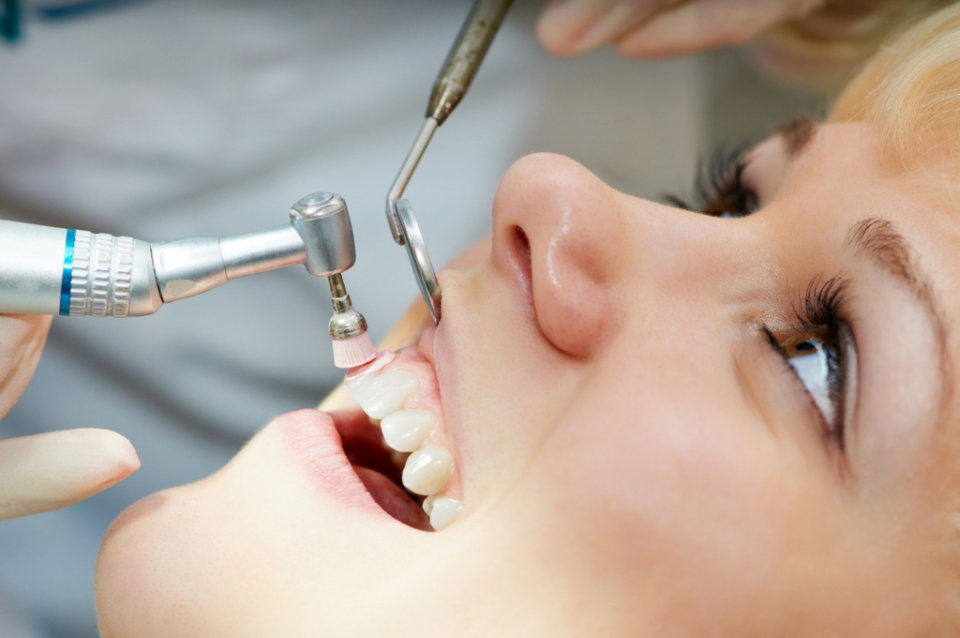 Stomatolog će očistiti i one zubne površine koje obično zanemarujete